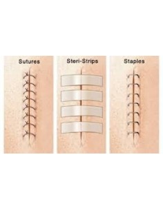 SUTURA CUTANEA ADHESIVA STERI-STRIP 12x100 MM. 1547R