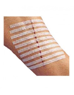 SUTURA CUTANEA ADHESIVA STERI-STRIP 12x100 MM. 1547R